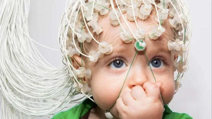Figure 3: EEG was used to see the prevalence of fetal memories. 